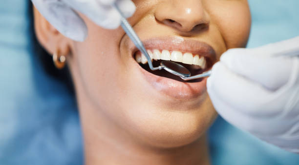 Best After-Hours Dental Trauma Care in Lompoc, CA