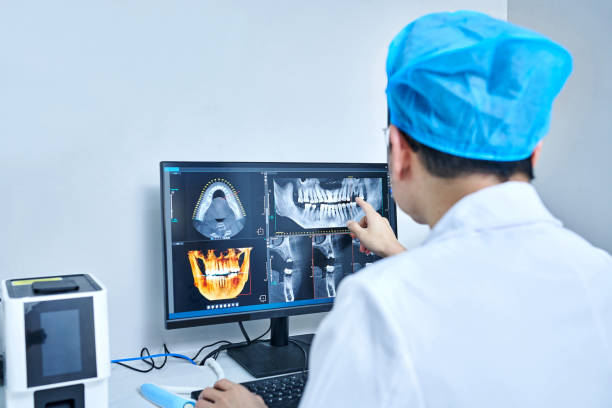 Best Emergency Dental Care for Broken or Chipped Teeth in Lompoc, CA